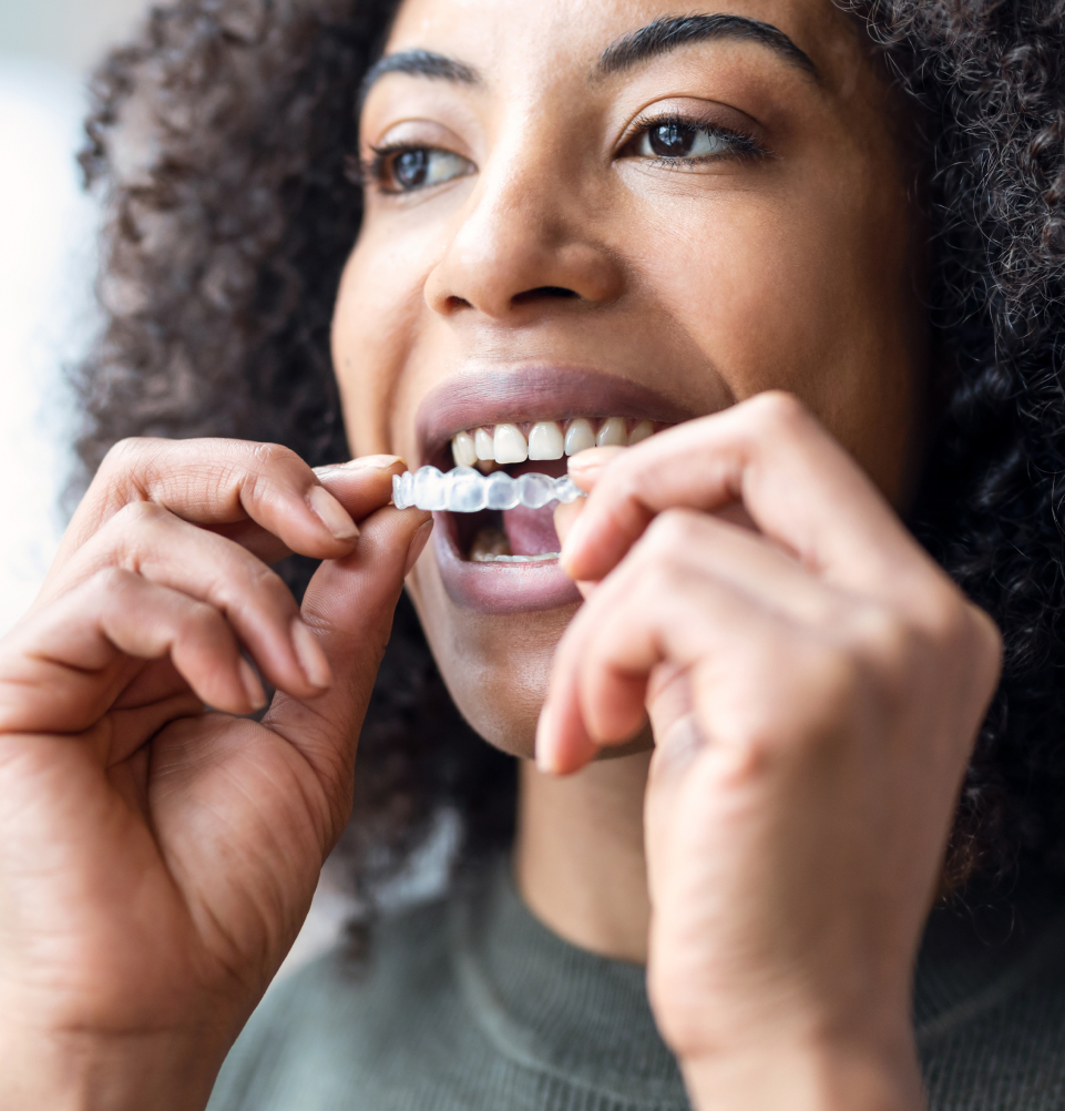 Qu’est-ce qu’Invisalign Qu’est-ce qu’Invisalign ?
